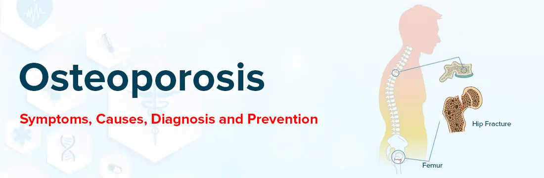 All About Osteoporosis: Symptoms, Causes, Diagnosis and Prevention